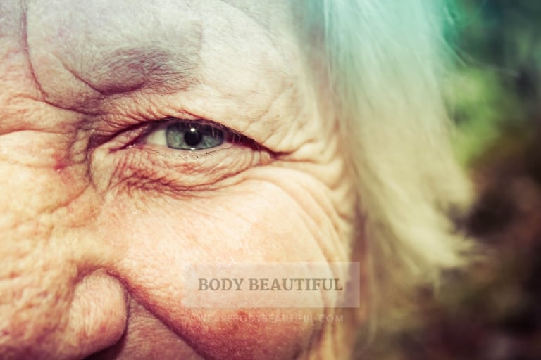 Close up of a mature ladies wrinkled eye. One of the reasons her skin is dry and wrinkled is because she has lost so much Hyaluronic Acid from her skin.