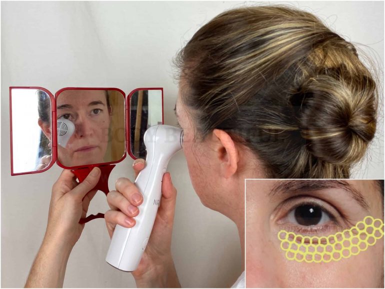 A handheld mirror smmall vanity mirror is helpful for safe and precise flashes with the NIRA laser.