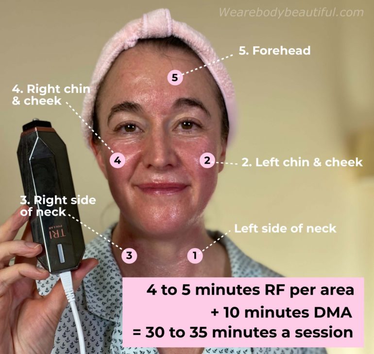 Tripollar STOP VX routine: my face with the 5 full face and neck treatment zones labelled, 4 to 5 mins per area, Total sessions time 30 to 35 mins
